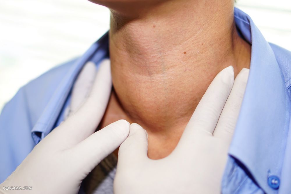 Thyroid / مهمترین علائم پرکاری تیروئید / علت پرکاری تیروئید / داروی پرکاری تیروئید / پرکاری تیروئید / درمان پرکاری تیروئید / 