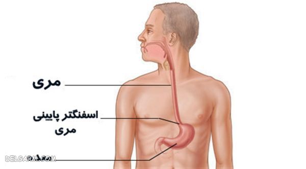 تنگی مری چیست 